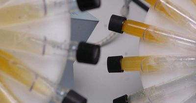 'Please stop sending unsolicited urine samples', Scottish GP pleads