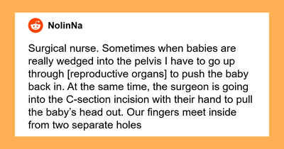 57 Surgeons Share The Weirdest Facts About The Human Body