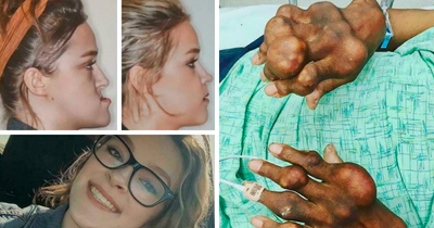 “The Eyes After Death”: 56 Of The Most Bizarrely Fascinating Photos Shared By Medical Professionals (New Pics)