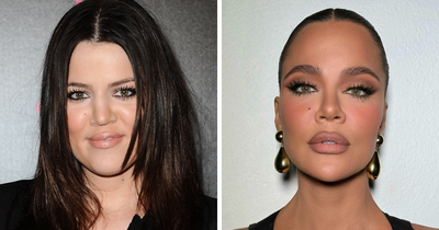 Khloé Kardashian Reveals Full List Of Cosmetic Procedures She’s Had Done So Far