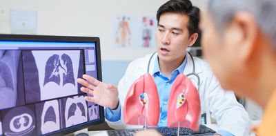 Lung cancer screening hopes to save lives. But we also need to watch for possible harms