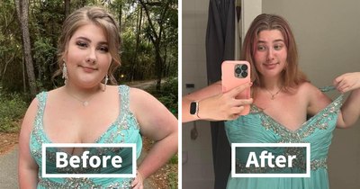 40 People Who Decided To Stun The Internet By Sharing Their Pics After Using Ozempic For Weight Loss