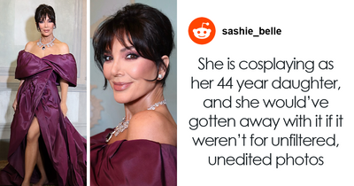 “Skeleton Barbie Leg”: Kris Jenner Accused Of “Worst Photoshop” Fail After Alleged $100k Facelift