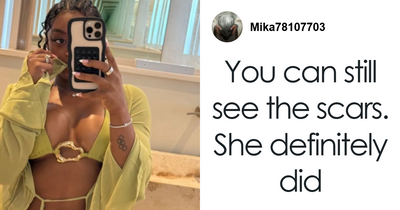 Simone Biles Sparks Plastic Surgery And ‘Retirement’ Rumors With New Look On Vacation