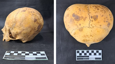 'Alien' skull of toddler is actually evidence of long-standing practice of head shaping