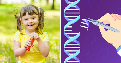 Scientists Cure Down Syndrome With Gene Editing In Groundbreaking First