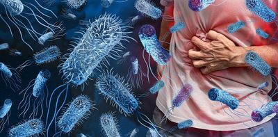 Salmonella cases are at ten-year high in England – here’s what you can do to keep yourself safe