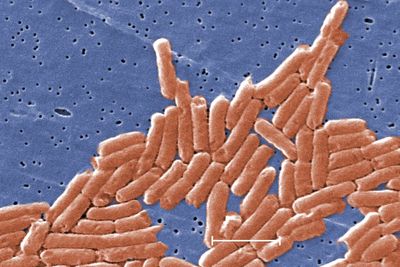 Here’s how to avoid Salmonella as cases in England reach ten-year high