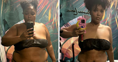 Lizzo Strips Down To Show Drastic Weight Loss, Comes Clean About How Exactly She Dropped Pounds