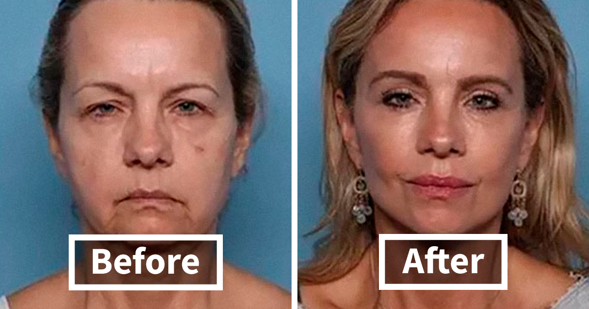 44 JawDropping BeforeAndAfter Photos Of People Who…