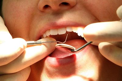Government reveals sweeping changes to fix ‘broken NHS dental system’