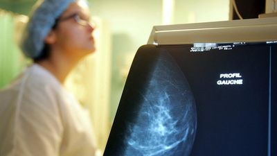 France’s mortality falls to record low in 2023, dropping below pre-Covid levels