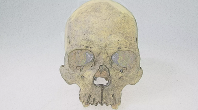 Rare form of leprosy infected people in Americas before European arrival, 4,000-year-old bones suggest