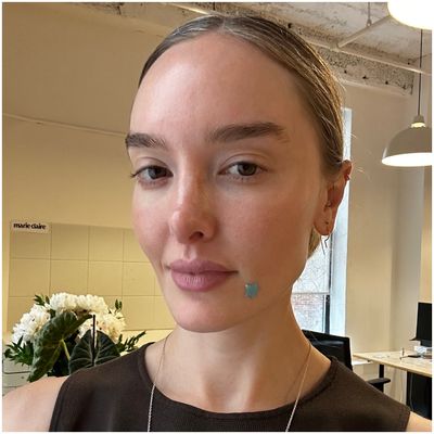 Yes, I’m 35 and I Still Have Breakouts—Here’s How I Tackle Them