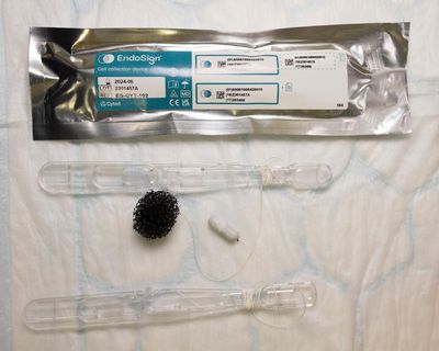 NHS pharmacies to pilot ‘sponge on a string’ test to spot cancer precursor