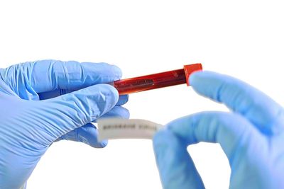 What is the infected blood scandal?