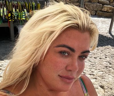 What Is 'Ozempic Face' and How To Avoid It: Gemma Collins Left Reeling by Side Effect of Weight-Loss Jab