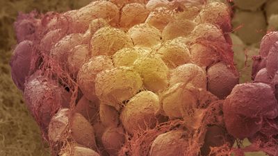 Weight loss may 'rejuvenate' fat tissues, clearing away aged cells