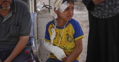Scotland's NHS ready to treat injured Gaza children, First Minister says