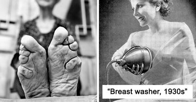 22 Unimaginable Things Women Did In The Past Just For The Sake Of ‘Beauty’