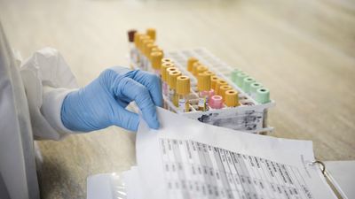 Is Microsoft's new AI still "4x more accurate than human doctors"? — Typos in medical prompts to chatbots could be catastrophic