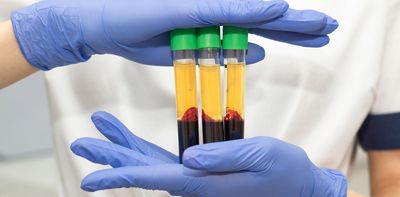 Trump has flagged 200% tariffs on Australian pharmaceuticals. What do we produce here, and what’s at risk?