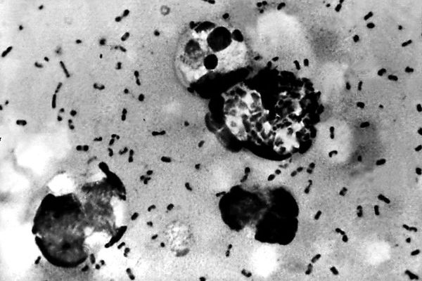 Arizona resident dies from the plague less than 24 hours after showing symptoms