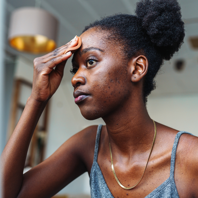 I’m Still Acne-Prone at 36—but This High-Tech Zit Zapper Has Proved Transformative
