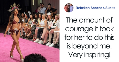 Woman Was Ashamed Of Her Ostomy Bag For Years Until One Trip Changed Her Life