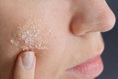 Why you should stop using ‘natural’ products like baking soda on your skin