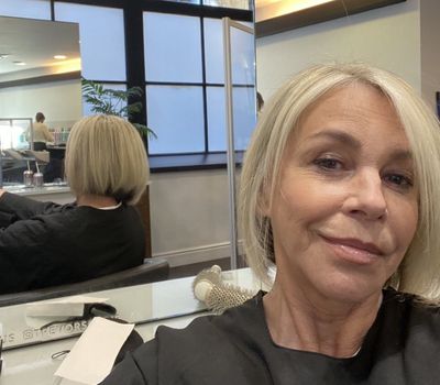 Leslie Ash New Face: Actress Did Not Go Under The Knife To Fix Lip Filler Accident - Here's What She Did