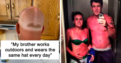 “I Don’t Need Sunscreen”: 50 People Who Thought So And Ended Up Looking Like Dorks (New Pics)