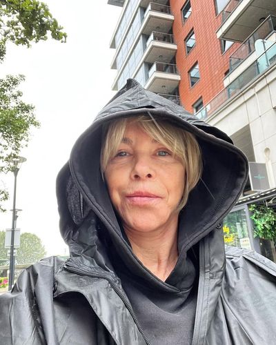 Leslie Ash Bounces Back From Filler Disaster and Looks 10 Years Younger