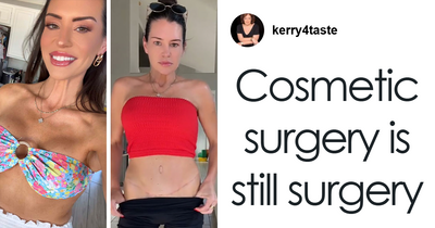 Woman Travels to Turkey for Mommy Makeover and Spends Just $14K