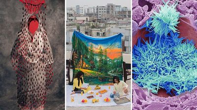 Wellcome Photography Prize 2025: When photography meets science, health and the human experience