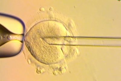 IVF technique using DNA from three people sees eight babies born free of hereditary disease