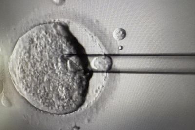 OPINION - Eight babies born from IVF technique to prevent devastating disease ...Tech & Science Daily podcast