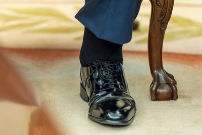 Here's what to know about chronic venous insufficiency