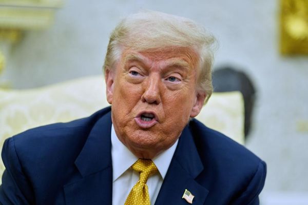 What is chronic venous insufficiency, the condition Trump was diagnosed with?