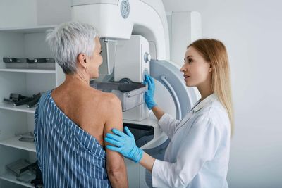 New test could revolutionise aftercare for thousands of breast cancer patients