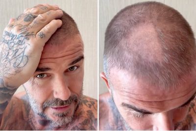 David Beckham left with bald patch after ‘terrible’ hair accident