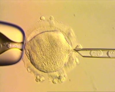 The Guardian view on mitochondrial donation: IVF innovation leads to a cautious genetic triumph