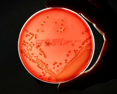 Superbugs could kill millions more and cost $2tn a year by 2050, models show