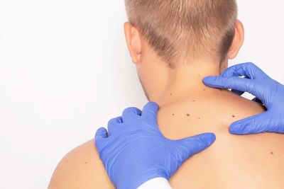 Groundbreaking AI tool could diagnose skin cancer early in remote areas