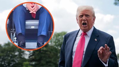 Turns out the president is not the picture of perfect health he’d have us believe