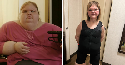 1000-Lb. Sisters’ Tammy Slaton Barely Recognizable After Showing Off Skin Removal Surgery Results