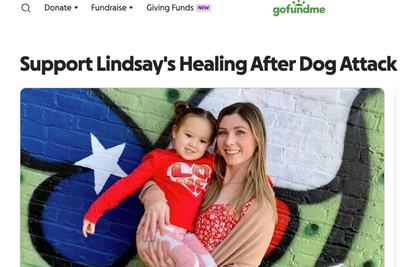 6-year-old calls 911 to help mom after two pit bulls attacked: ‘She definitely saved her mom’s life’