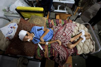 Gaza logs 15 new deaths from hunger, taking toll since Israel’s war to 101
