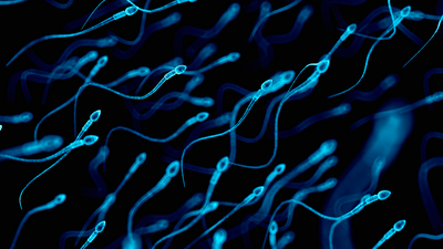 Diagnostic dilemma: Rare semen allergy may have caused woman's infertility