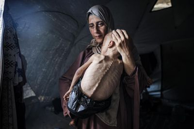 Starvation in Gaza is destroying communities – and will leave generational scars
